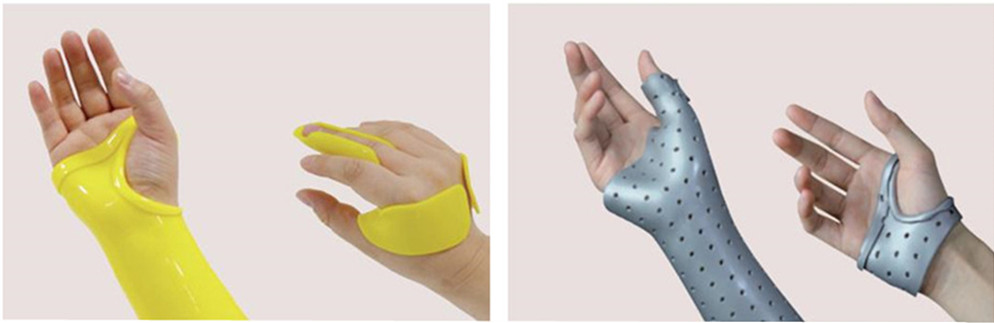 hand orthoses.jpg