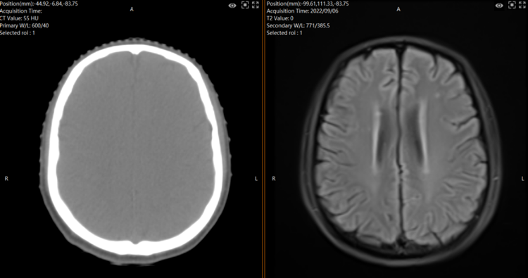 CT and MR image.png