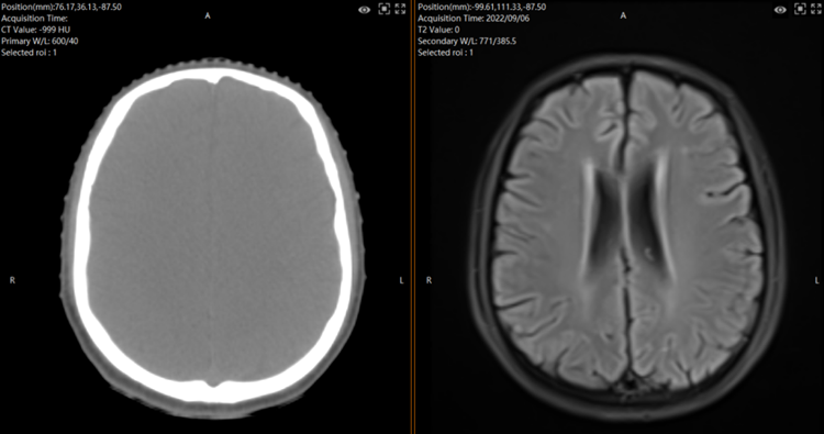 CT and MR image 2.png